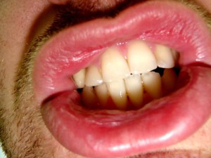 dientes 3