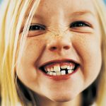 Dientes Niños - Clínica Dental Arancha Otero