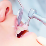 ¿Cómo se realiza una limpieza dental?