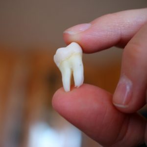 tipos de dientes y su función